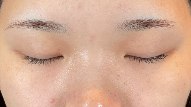 手術前の状態 その1