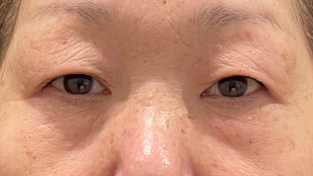 手术前的状态 其一