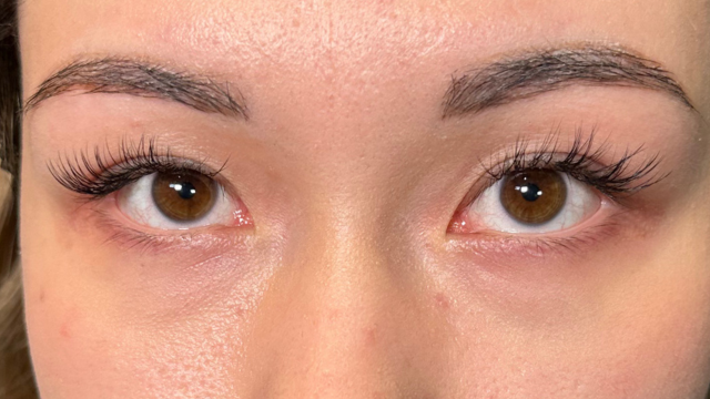 手术前的状态 其一