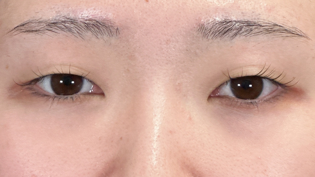 手术前的状态 其一