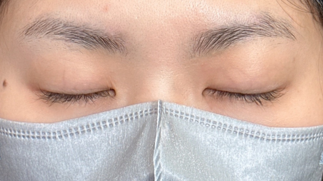 手术前的状态 其一