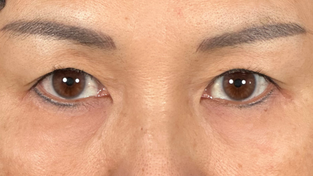 Postoperative Condition Part 1