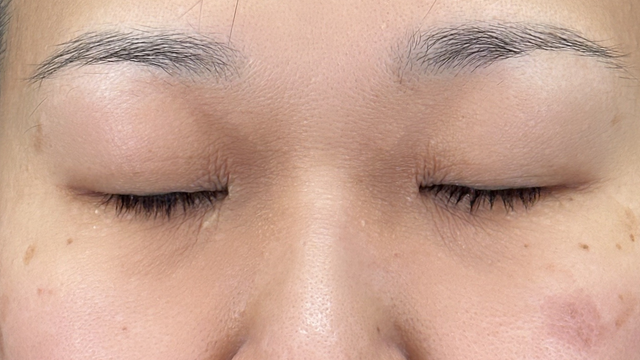 Postoperative Condition Part 1