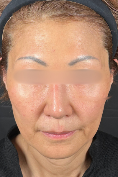 手术前的状态 其一