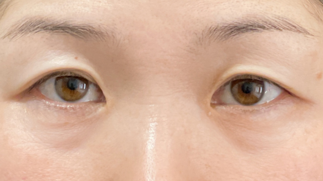 手术前的状态 其一