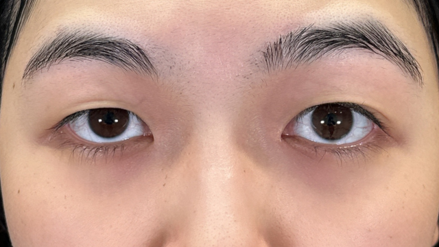 手术前的状态 其一