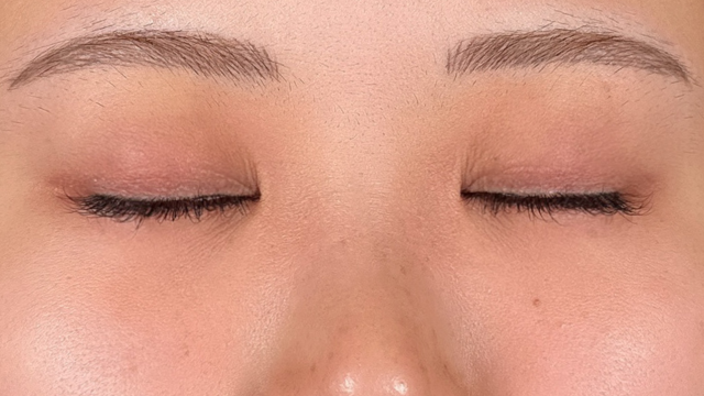 手术前的状态 其一