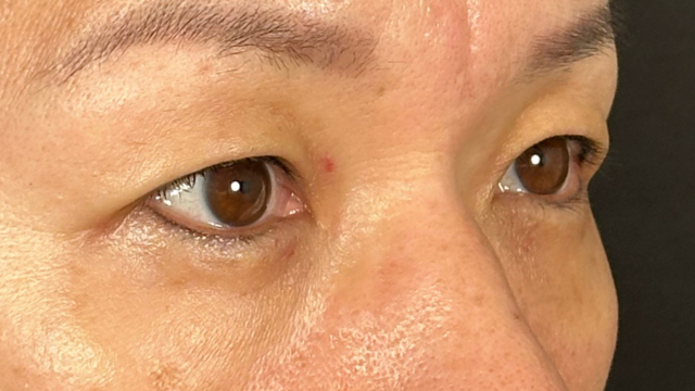 Postoperative Condition Part 1