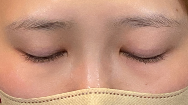 手术前的状态 其一