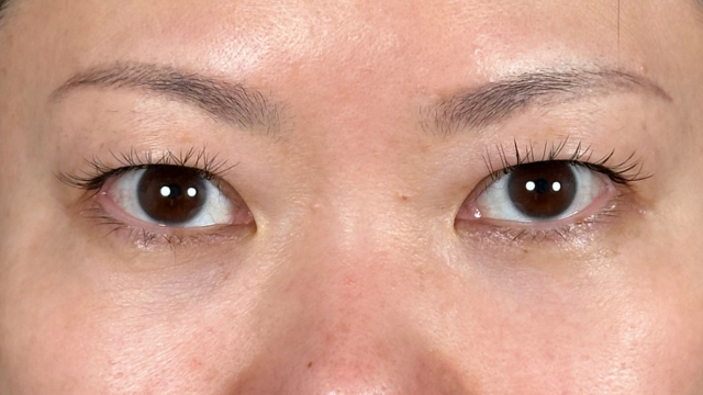 手术前的状态 其一