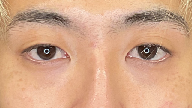 手术前的状态 其一