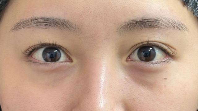 手术前的状态 其一