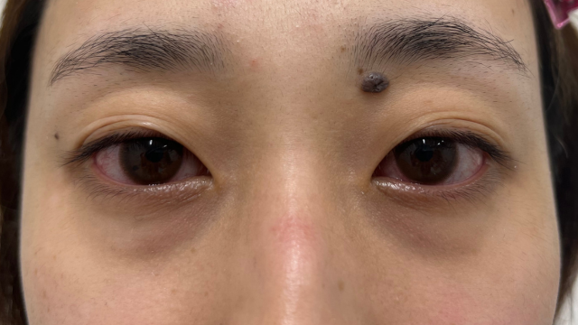 手术前的状态 其一