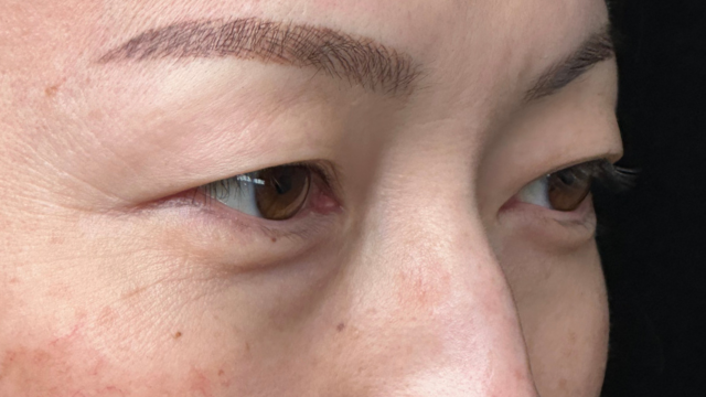 手术前的状态 其一