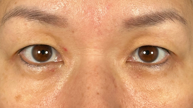 Postoperative Condition Part 1