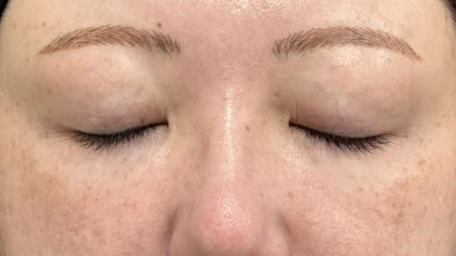 手术前的状态 其一