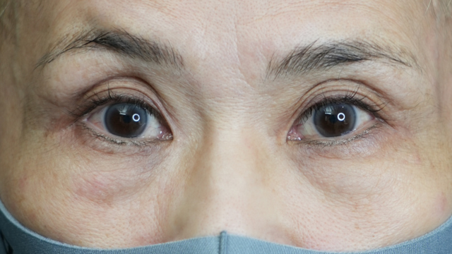 手术前的状态 其一