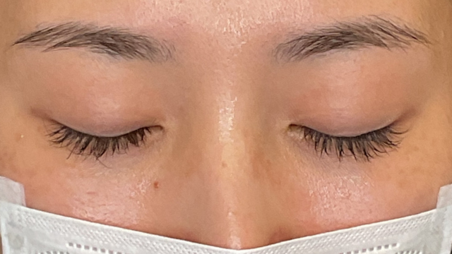 手术前的状态 其一