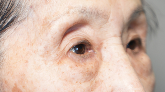 Postoperative Condition Part 1