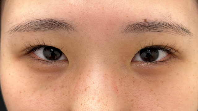 手术前的状态 其一