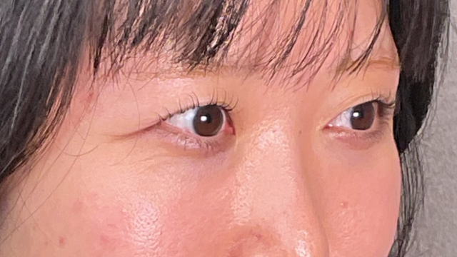 手术前的状态 其一