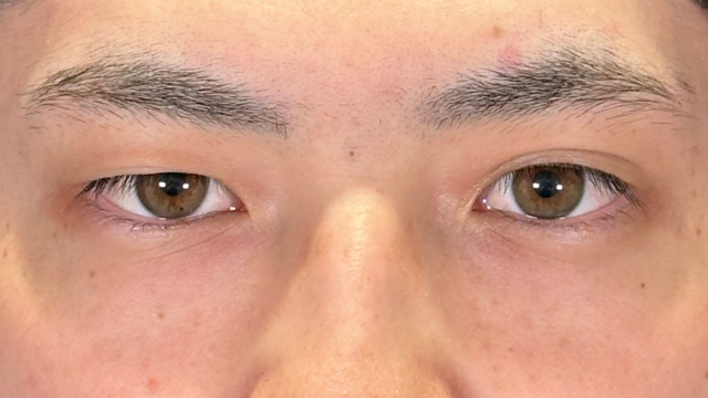 Postoperative Condition Part 1