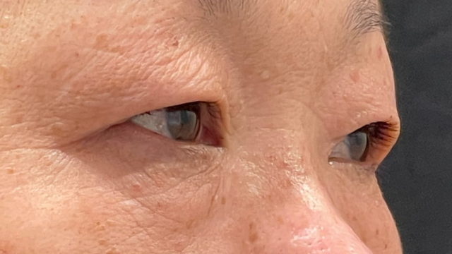 手术前的状态 其一