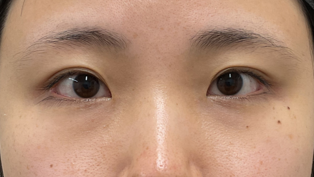 手术前的状态 其一