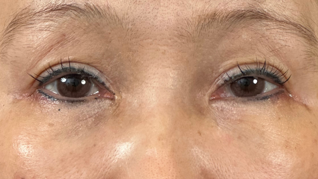 手术前的状态 其一