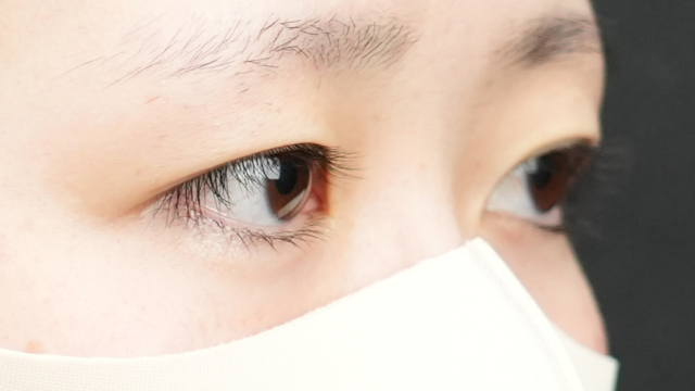 手术前的状态 其一