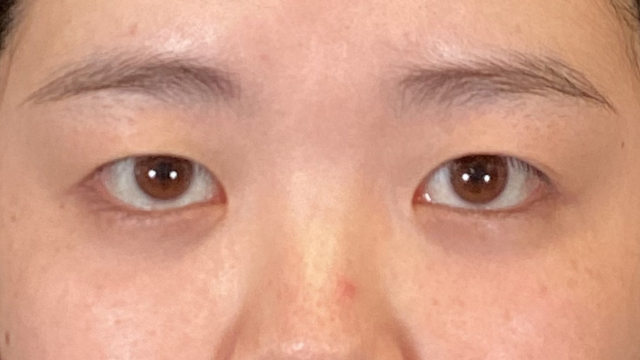 手术前的状态 其一