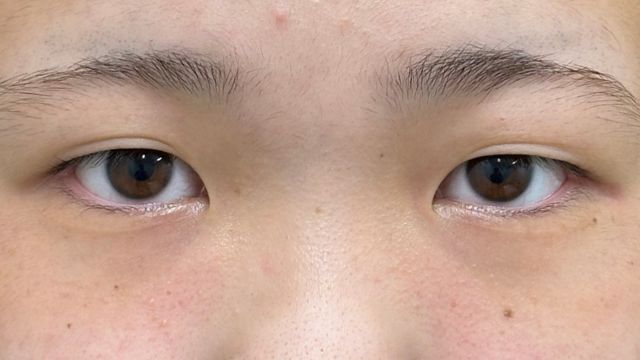 Postoperative Condition Part 1