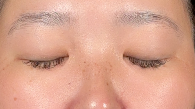 手术前的状态 其一