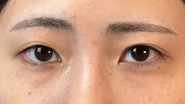 Postoperative Condition Part 1