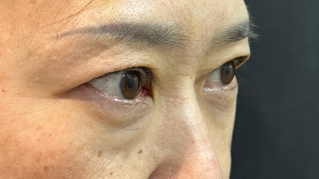 Postoperative Condition Part 1