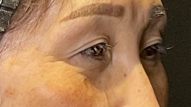 手术前的状态 其一