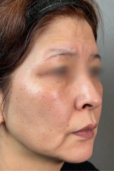 手術前の状態 その1