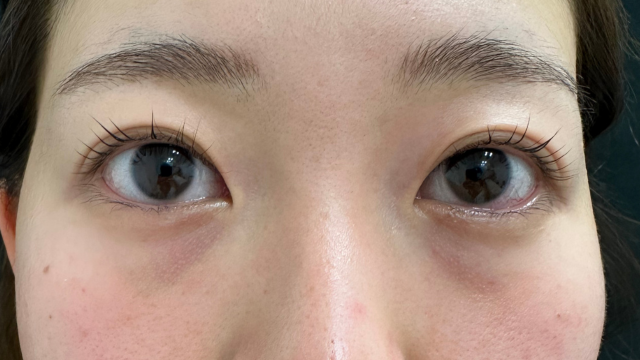 手术前的状态 其一