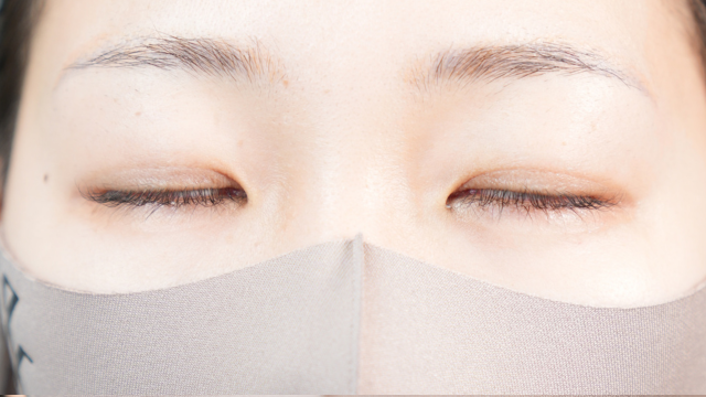 手術前の状態 その1