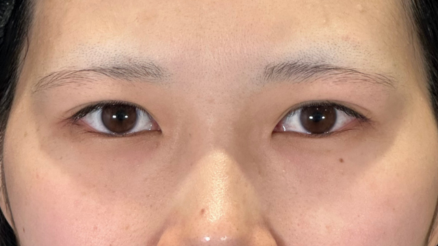 手術前の状態 その1