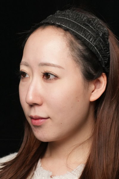 手术前的状态 其一