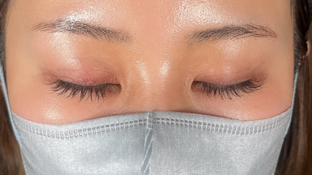 手术前的状态 其一