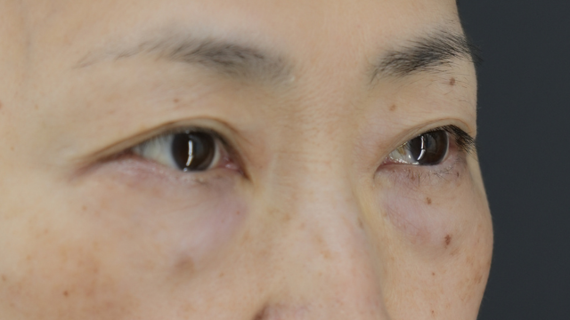 Postoperative Condition Part 1