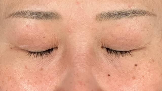 手术前的状态 其一