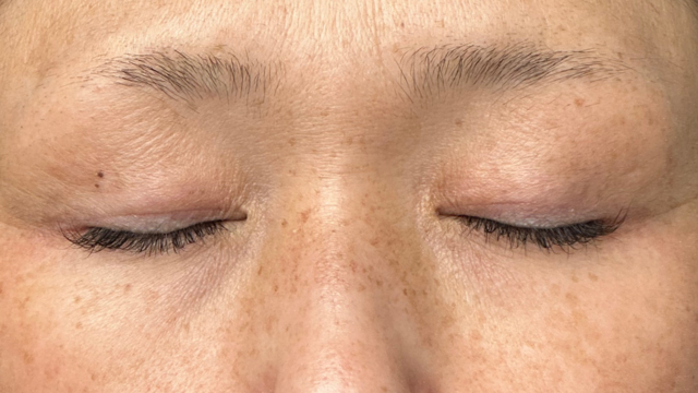 Postoperative Condition Part 1