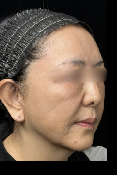 手術前の状態 その1