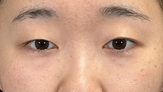 Postoperative Condition Part 1