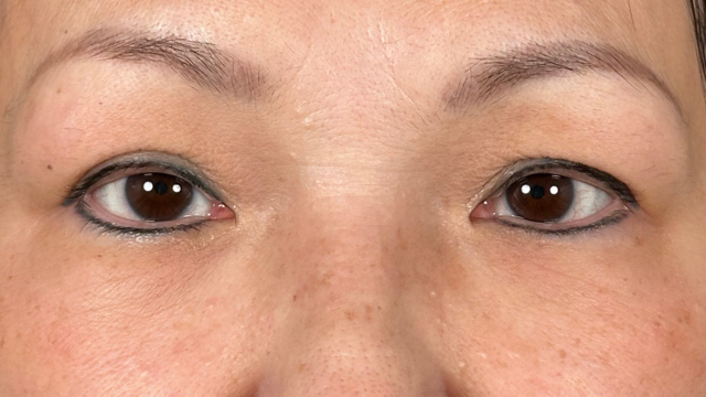 Postoperative Condition Part 1