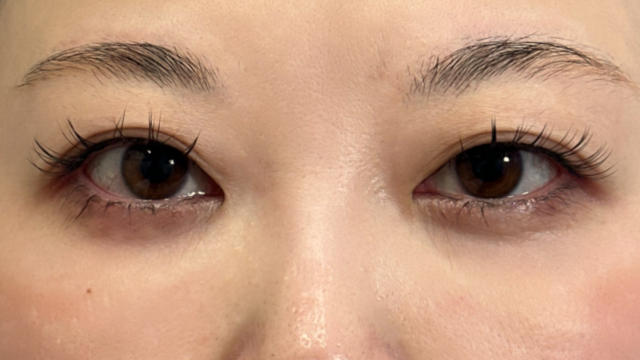 手术前的状态 其一