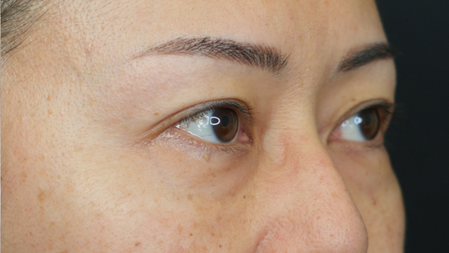 Postoperative Condition Part 1